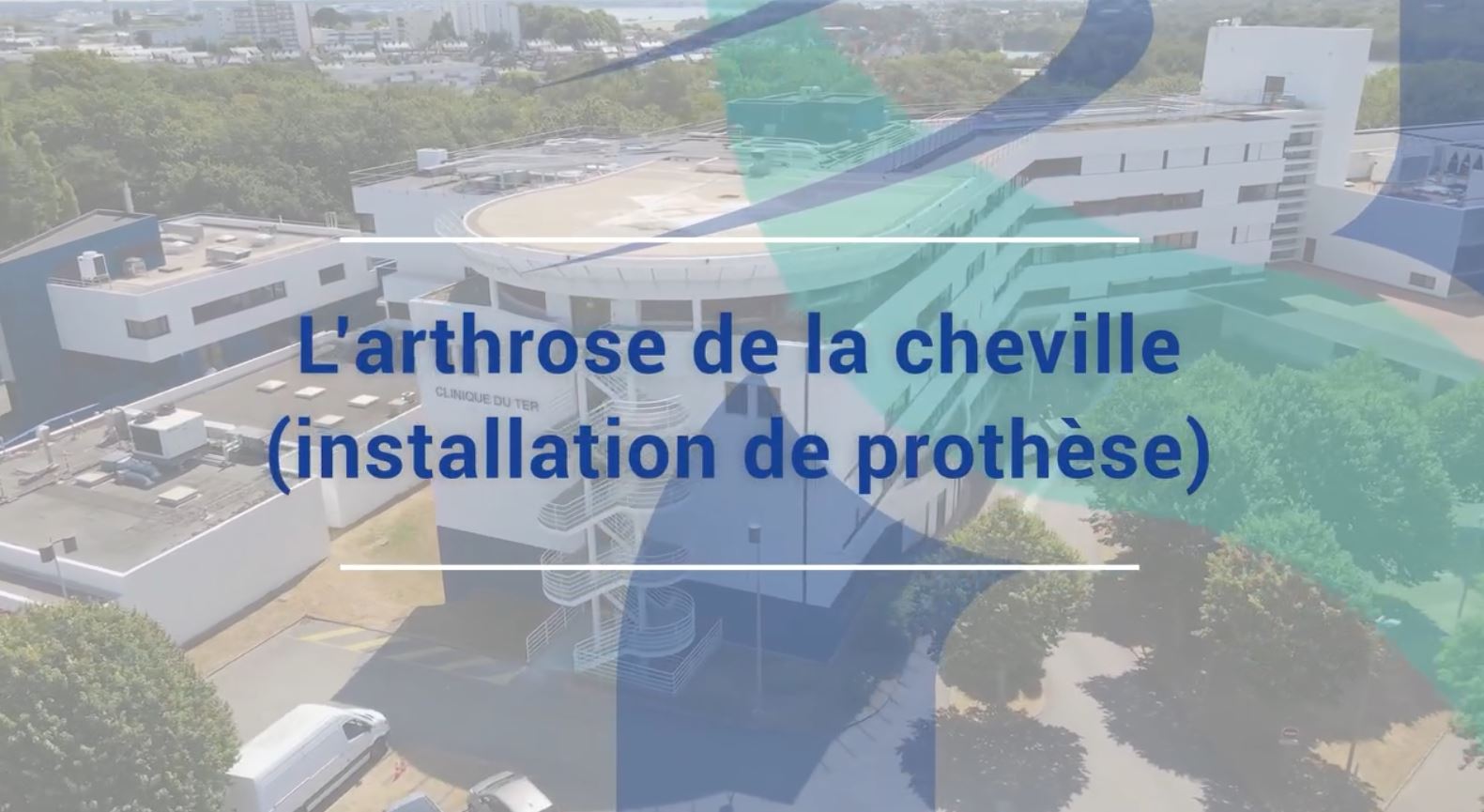 [RDV Infos Santé] - L'arthrose et la prothèse de cheville 