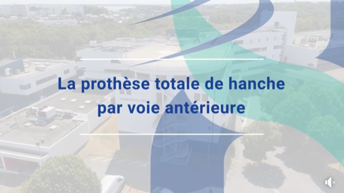 [RDV Infos Santé] - La prothèse totale de hanche par voie antérieure