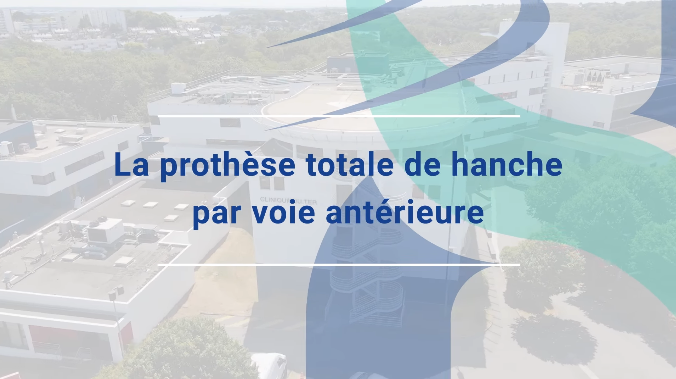 [RDV Infos Santé] - La prothèse totale de hanche par voie antérieure