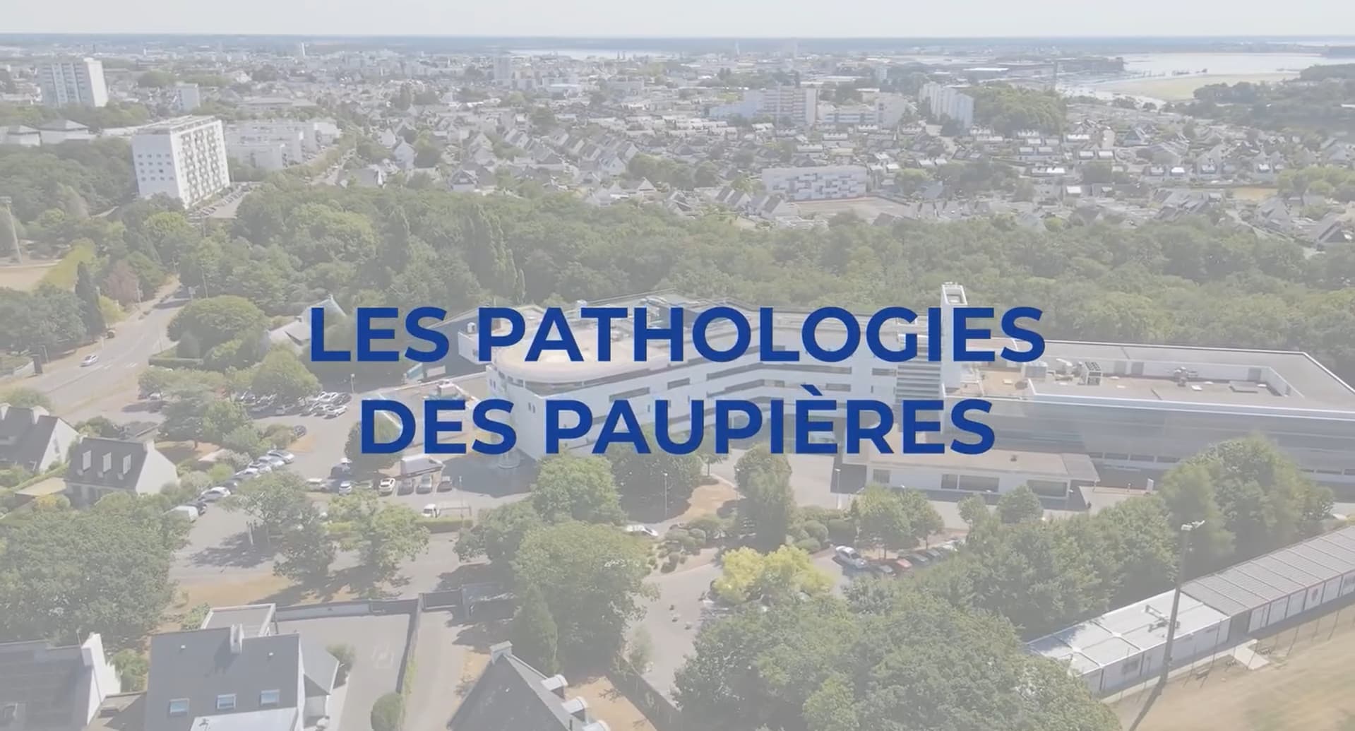 [Rdv Info Santé] - Pathologies des paupières : les différents types de tumeurs