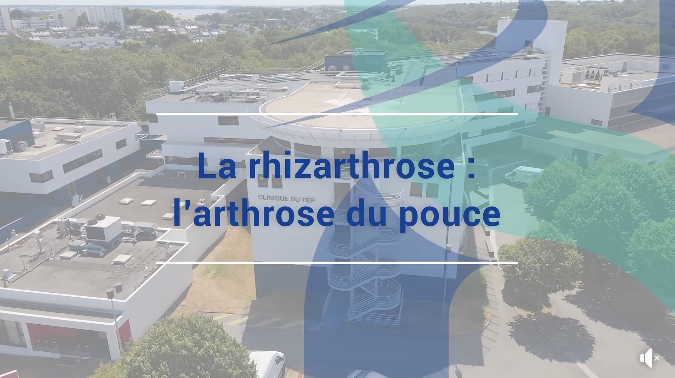 L'arthrose du pouce (rhizarthrose)