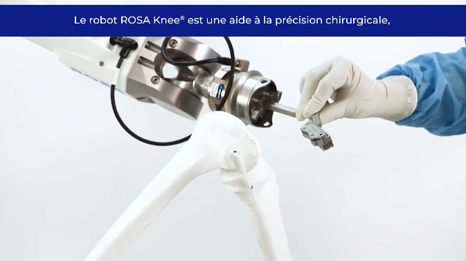 Journée mondiale de l'orthopédie : La prothèse de genou avec assistance robotisée 