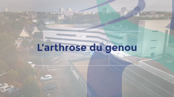 [RDV Infos Santé] - L'arthrose du genou 