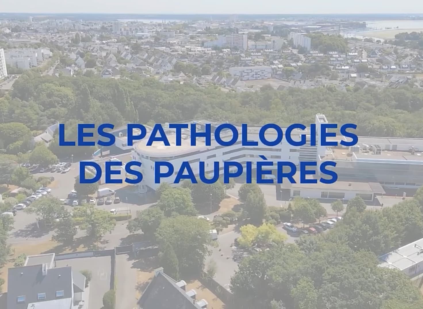 [RDV Infos Santé] - Pathologies des paupières : Chirurgie esthétique