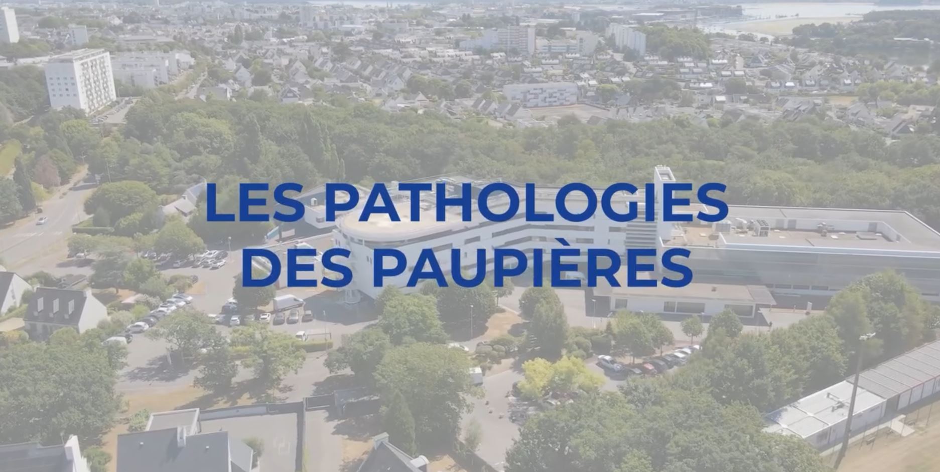 [RDV Infos santé] – Pathologies des paupières : Ectropion et Entropion