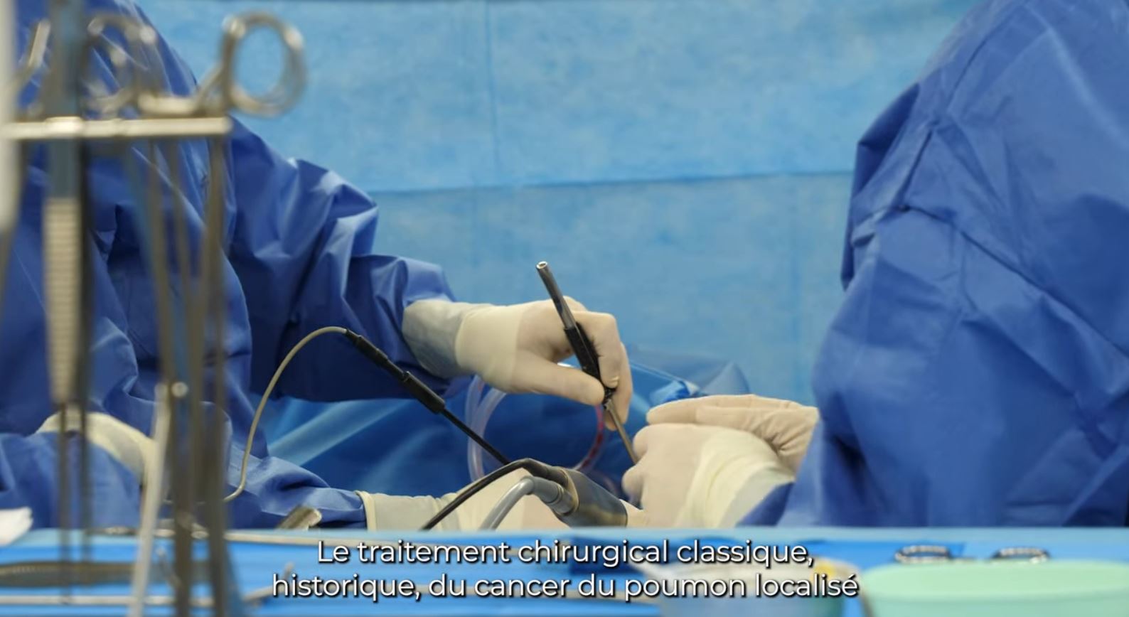 [Innovation] - Cancer du poumon : La segmentectomie